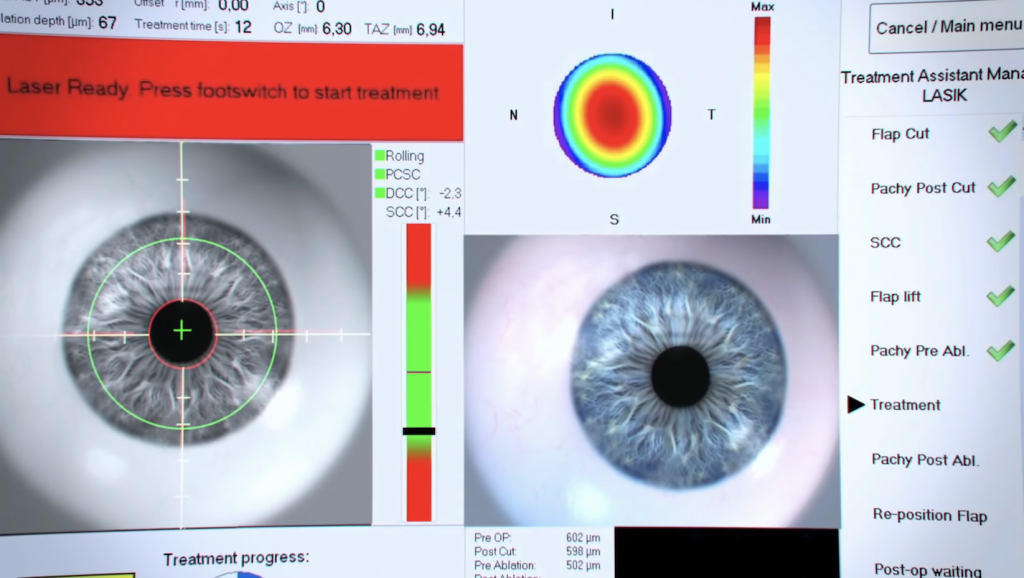 5 Reasons Why The Final Destination Lasik Scene Is Completely Unrealistic Clearvision Eye 